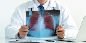 Doctor examining a patient’s chest X-ray for lung cancer screening in a hospital setting