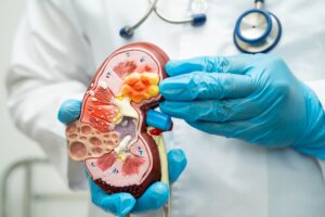 Doctor examining a kidney model while discussing chronic kidney disease (CKD) treatment in a hospital setting