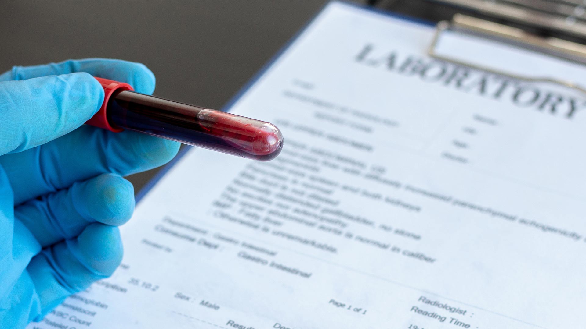 Blue-gloved hand holding a blood vial over a lab report, illustrating the new cholesterol guidelines and LDL testing