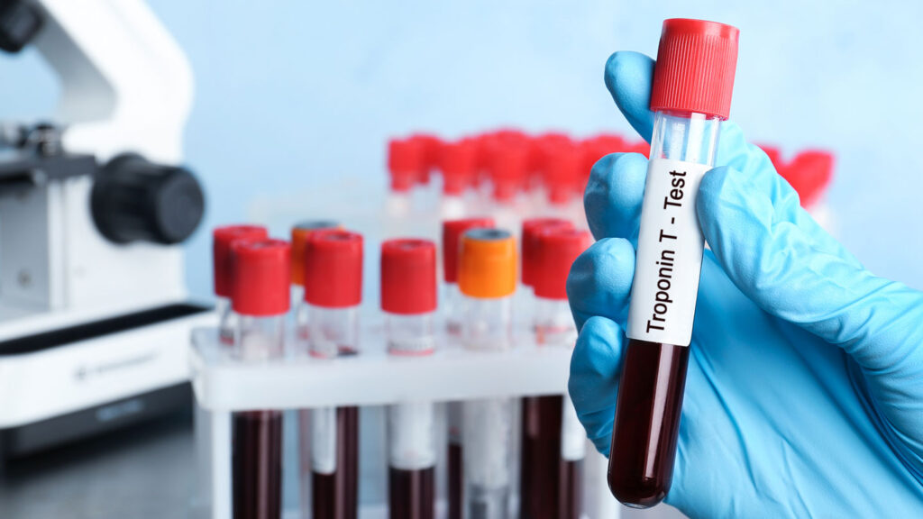 Blue-gloved hand holding a blood sample labeled “Troponin test,” illustrating troponin test myths and emergency room overtreatment